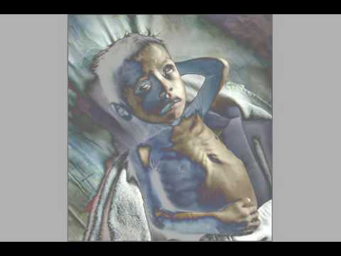 how to cure kwashiorkor