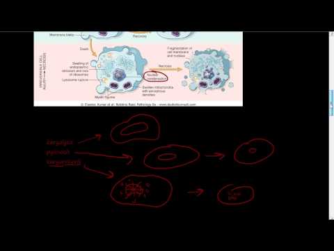 #8 – Micro and Macro morphology of necrosis – karyolysis, pyknosis, karyorrhexis, necrosis.