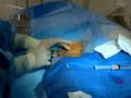 Podcast: Cardiac Catheterization with Angioplasty & Stent...