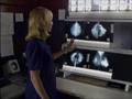 Inflammatory Breast Cancer