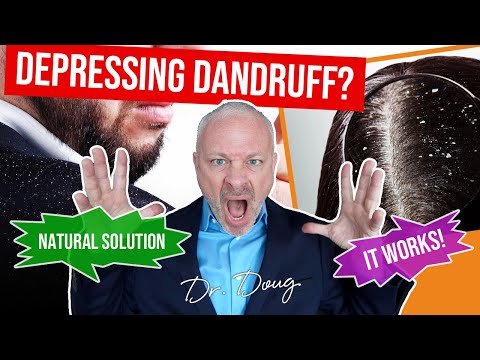 how to cure excessive dandruff