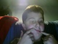 i got my stitches tacken out