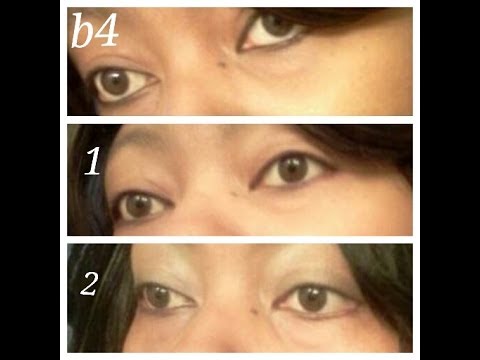 how to whiten sclera of eyes naturally