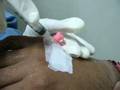 Injection of Contrast