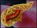 diabetes mellitus part1