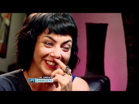 Dr. Drew Meets Bibi, Who Suffers from Cystic Acne