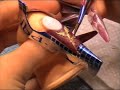 acrylic nail modelling  grape rod 