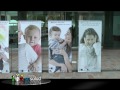 Inmunodeficiencias primarias