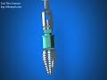 Become a Dentist - Dental Implants Become a Dentist - Dental Implants