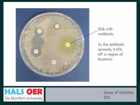 how to measure zone of inhibition bacteria