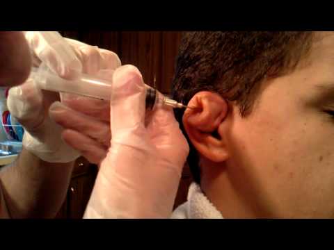 how to relieve fluid in ears at home