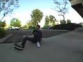 Broken Ankle