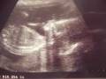videos de Liam.wmv