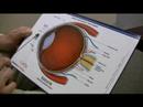 Dr. Earle Eye Chart Lesson 2.0 Dr. Earle Eye Chart Lesson 2.0
