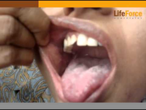 oral pics