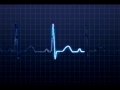 PQRS.avi PQRS.avi