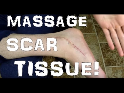 how to perform scar massage
