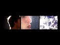 Troy von Balthazar - I Block The Sunlight Out