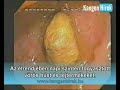 Videó megtekintése