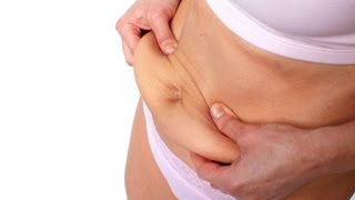 与腹部脂肪分手:腹部整形手术适合你吗?