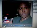 Pit bull attacks 5-Year-Old Boy Walking from School
