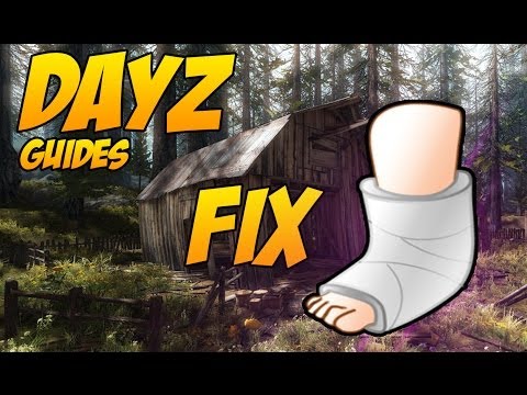 how to repair broken bones dayz