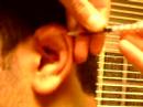 Jokers Wild Fighting 2008 Cauliflower Ear