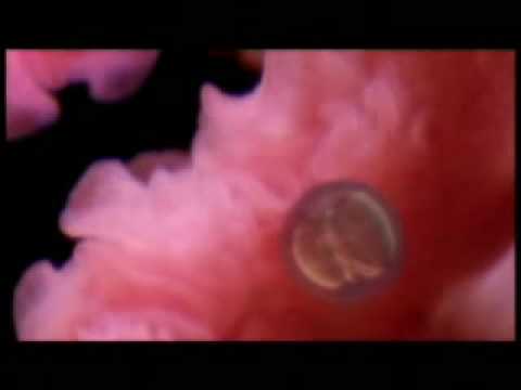 Ver video