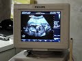 Ultrasound Video 14th week 01