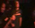Tardive dyskinesia Soul paramedics [live]