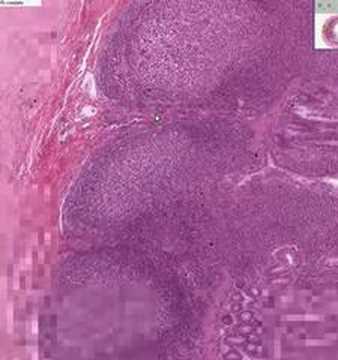 Shotgun Histology Small Intestine Ileum