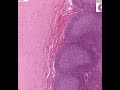 Shotgun Histology Small Intestine Ileum