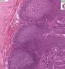 Shotgun Histology Small Intestine Ileum
