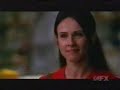 Nip/Tuck - 2.04  Mrs. Grubman - Mrs. Grubman's surgery