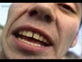 hip hop chileno panteras negras  rapulento real from chile