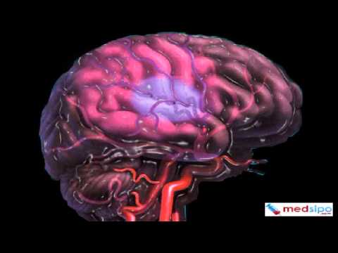 how to perform tpha test