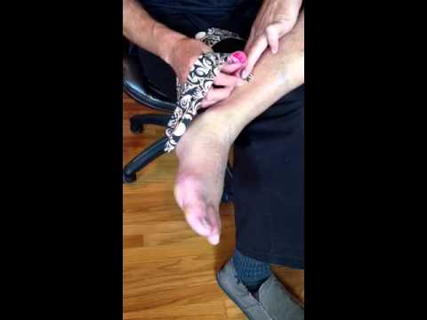 how to relieve sprained foot