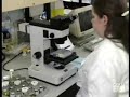 Microscopic Urine Examination Microscopic Urine Examination