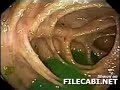 akibat makan babi...