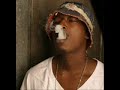 young zee-tonsil check young zee-tonsil check