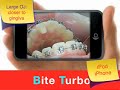 Bite Turbo