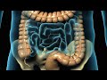 Laparoscopic Appendectomy Surgery for Appendicitis