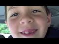 David Depois do Dentista 2