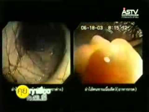 น้ำด่าง - น้ำเป็นหนึ่งในปัจจัยที่สำคัญในการดำเนินชีวิต โปรดอย่ามองข้าม เพื่อสุขภาพที่ดีของท่าน.