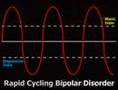 What is Bipolar Disorder? (Bipolar #1)