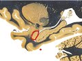 Neuroanatomy: Sagittal Slice @ Hippocampus Neuroanatomy: Sagittal Slice @ Hippocampus