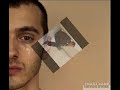 Episodios Depresivos y Suicidio Adolescente