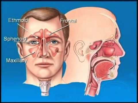 how to relieve sinus pressure