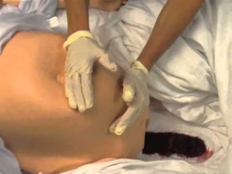 how to perform fundal massage