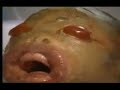 Bebe Malformado que se piensan que es extraterrestre